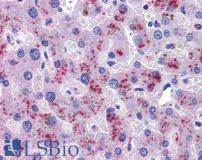 Anti-Hemopexin antibody IHC of human liver. Immunohistochemistry of formalin-fixed, paraffin-embedded tissue after heat-induced antigen retrieval. Antibody LS-B3811 concentration 3.75 ug/ml.