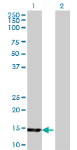 Western Blot analysis of UBE2B expression in transfected 293T cell line by UBE2B monoclonal antibody (M06), clone 4C3.Lane 1: UBE2B transfected lysate(17.3 KDa).Lane 2: Non-transfected lysate.