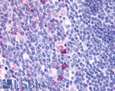 Anti-GPR137 antibody LS-A2059 IHC of human tonsil. Immunohistochemistry of formalin-fixed, paraffin-embedded tissue after heat-induced antigen retrieval.