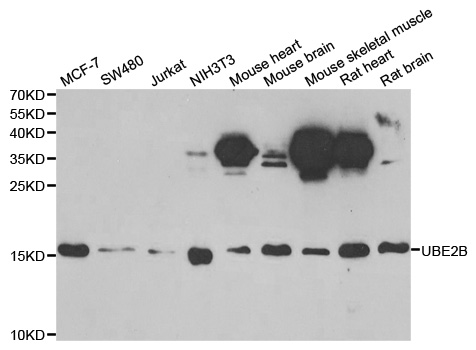Western blot analysis of extracts of various cell lines, using UBE2B antibody.