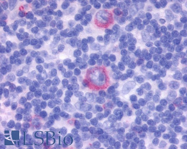 Anti-GPR137 antibody IHC of human Lymph Node, Hodgkins Lymphoma. Immunohistochemistry of formalin-fixed, paraffin-embedded tissue after heat-induced antigen retrieval.