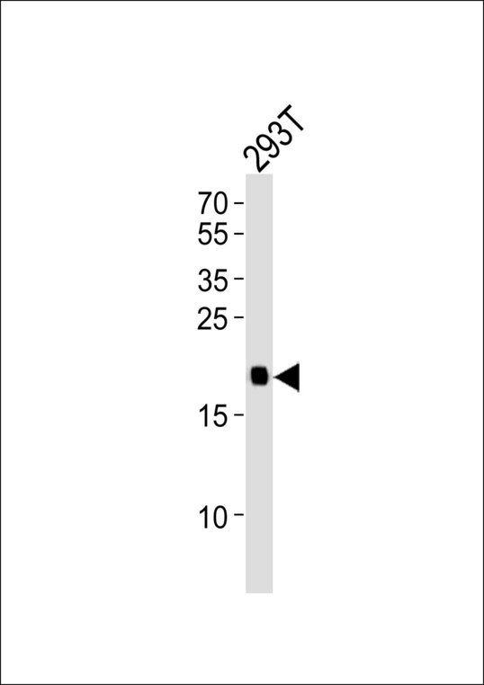 Western blot of lysate from 293T cell line, using HRAS Antibody. Antibody was diluted at 1:1000. A goat anti-rabbit IgG H&L (HRP) at 1:10000 dilution was used as the secondary antibody. Lysate at 20ug.