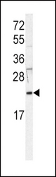Western blot of anti-HRAS Antibody in Jurkat cell line lysates (35 ug/lane). HRAS (arrow) was detected using the purified antibody.