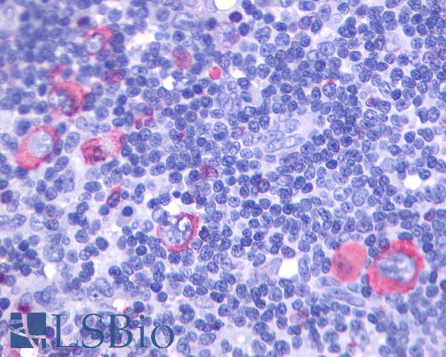 Anti-GPR137 antibody IHC of human Lymph Node, Hodgkins Lymphoma. Immunohistochemistry of formalin-fixed, paraffin-embedded tissue after heat-induced antigen retrieval.