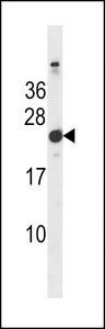 Mouse Hras1 Antibody western blot of mouse bladder tissue lysates (35 ug/lane). The Mouse Hras1 antibody detected the Mouse Hras1 protein (arrow).