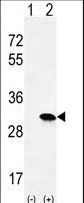 Western blot of HRAS (arrow) using rabbit polyclonal HRAS Antibody. 293 cell lysates (2 ug/lane) either nontransfected (Lane 1) or transiently transfected (Lane 2) with the HRAS gene.