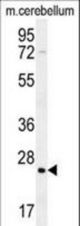 HRAS Antibody western blot of mouse cerebellum tissue lysates (35 ug/lane). The HRAS antibody detected the HRAS protein (arrow).