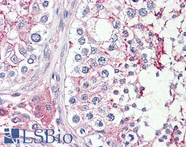 Anti-HRASLS antibody IHC of human testis. Immunohistochemistry of formalin-fixed, paraffin-embedded tissue after heat-induced antigen retrieval. Antibody LS-B7365 concentration 3.75 ug/ml.