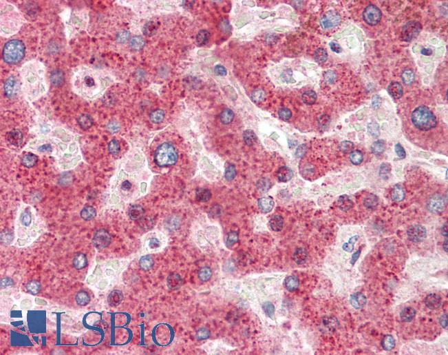 Anti-HRASLS2 antibody IHC staining of human liver. Immunohistochemistry of formalin-fixed, paraffin-embedded tissue after heat-induced antigen retrieval. Antibody LS-B10329 concentration 5 ug/ml.