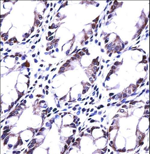 HRASLS5 Antibody immunohistochemistry of formalin-fixed and paraffin-embedded human rectum tissue followed by peroxidase-conjugated secondary antibody and DAB staining.