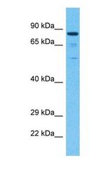 Western blot of SRCH Antibody with human 293T Whole Cell lysate.