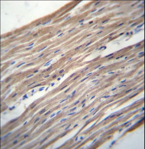 HRC Antibody immunohistochemistry of formalin-fixed and paraffin-embedded human heart tissue followed by peroxidase-conjugated secondary antibody and DAB staining.