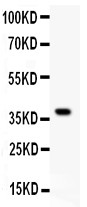 HRG antibody Western blot. All lanes: Anti HRG at 0.5 ug/ml. WB: Recombinant Human HRG Protein 0.5ng. Predicted band size: 40 kD. Observed band size: 40 kD.