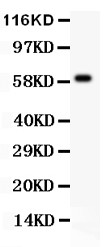 HRG antibody Western blot. All lanes: Anti HRG at 0.5 ug/ml. WB: Human Placenta Tissue Lysate at 50 ug. Predicted band size: 60 kD. Observed band size: 60 kD.