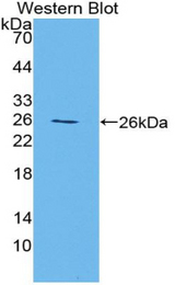 Western blot of recombinant HRG.