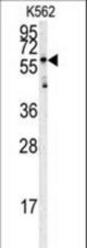 Western blot of HRG antibody in K562 cell line lysates (35 ug/lane). HRG (arrow) was detected using the purified antibody.