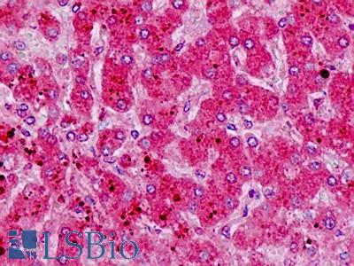 Anti-HRH1 / Histamine H1 Receptor antibody IHC staining of human liver. Immunohistochemistry of formalin-fixed, paraffin-embedded tissue after heat-induced antigen retrieval.