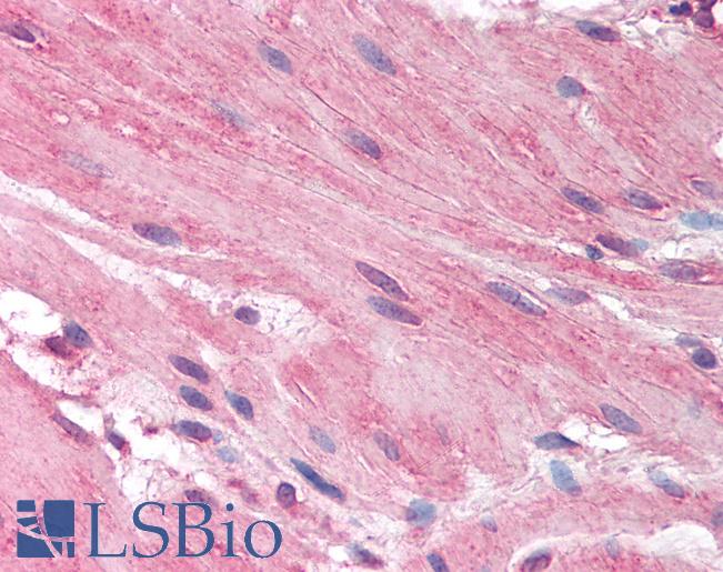 Anti-HRH1 / Histamine H1 Receptor antibody IHC of human small intestine, smooth muscle. Immunohistochemistry of formalin-fixed, paraffin-embedded tissue after heat-induced antigen retrieval. Antibody LS-B1745 concentration 5 ug/ml.