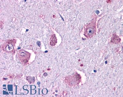 Anti-HRH1 / Histamine H1 Receptor antibody LS-A1167 IHC of human brain, neurons and glia. Immunohistochemistry of formalin-fixed, paraffin-embedded tissue after heat-induced antigen retrieval.