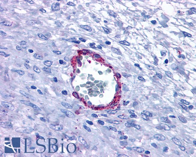 Anti-HRH1 / Histamine H1 Receptor antibody IHC of human Vessel. Immunohistochemistry of formalin-fixed, paraffin-embedded tissue after heat-induced antigen retrieval.