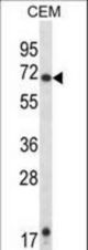 HRH1 Antibody western blot of CEM cell line lysates (35 ug/lane). The HRH1 antibody detected the HRH1 protein (arrow).