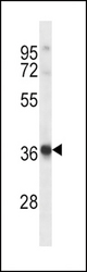 HRH2 Antibody western blot of Uterus tissue lysates (35 ug/lane). The HRH2 antibody detected the HRH2 protein (arrow).