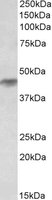HRH2 antibody (0.1 ug/ml) staining of Duodenum lysate (35 ug protein/ml in RIPA buffer). Primary incubation was 1 hour. Detected by chemiluminescence.