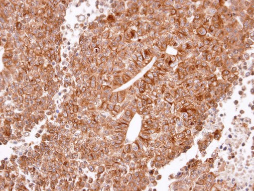 IHC of paraffin-embedded H520 xenograft using Histamine H2 Receptor antibody at 1:100 dilution.