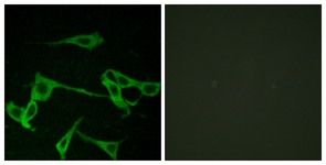 Immunofluorescence of LOVO cells, using HRH2 Antibody. The picture on the right is treated with the synthesized peptide.