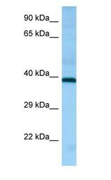 HRH2 / Histamine H2 Receptor antibody Western Blot of Fetal Brain.
