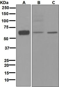 Western blot analysis on (A) fetal brain, (B) SH-SY5Y, and (C) human adrenal gland lysates using anti-Histamine H2 Receptor antibody.