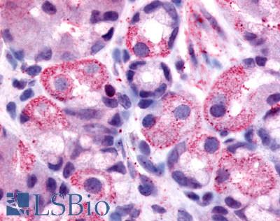 Anti-HRH2 / Histamine H2 Receptor antibody LS-A1175 IHC of human stomach, parietal cells. Immunohistochemistry of formalin-fixed, paraffin-embedded tissue after heat-induced antigen retrieval.