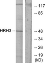 Western blot of extracts from COLO205 cells, using HRH3 Antibody. The lane on the right is treated with the synthesized peptide.