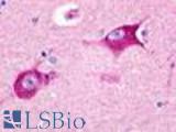 Anti-HRH3 / Histamine H3 Receptor antibody LS-A475 IHC of human brain, neurons and glia. Immunohistochemistry of formalin-fixed, paraffin-embedded tissue after heat-induced antigen retrieval.
