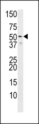 Western blot of anti-HH3R antibody (Rabbit ID 1071) in Jurkat cell line lysate (35 ug/lane). HH3R(arrow) was detected using the purified antibody. This western blot identifies isoform two of HRH3. The accession number of HRH3 is CAC39434; Q9Y5N1.