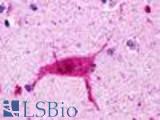 Anti-HRH3 / Histamine H3 Receptor antibody LS-A476 IHC of human brain, neurons and glia. Immunohistochemistry of formalin-fixed, paraffin-embedded tissue after heat-induced antigen retrieval.
