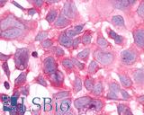 Anti-HRH3 / Histamine H3 Receptor antibody LS-A476 immunocytochemistry (ICC) staining of HEK293 human embryonic kidney cells transfected with HRH3 / Histamine H3 Receptor.
