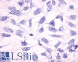 Anti-HRH3 / Histamine H3 Receptor antibody LS-A476 immunocytochemistry (ICC) staining of untransfected HEK293 human embryonic kidney cells.