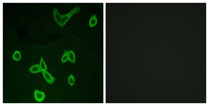 Immunofluorescence of LOVO cells, using HRH4 Antibody. The sample on the right was incubated with synthetic peptide.