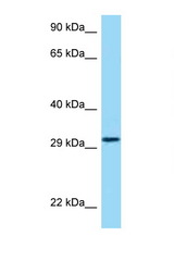 HRH4 / Histamine H4 Receptor antibody LS-C146254 Western blot of 721_B Cell lysate. Antibody concentration 1 ug/ml.