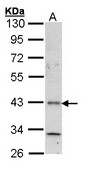 Sample (30 ug of whole cell lysate). A: A431 . 10% SDS PAGE. Histamine H4 Receptor antibody diluted at 1:1000.