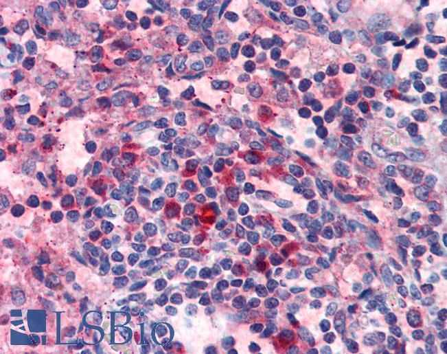 Anti-HRH4 / Histamine H4 Receptor antibody LS-A1901 IHC of human lymph node. Immunohistochemistry of formalin-fixed, paraffin-embedded tissue after heat-induced antigen retrieval.