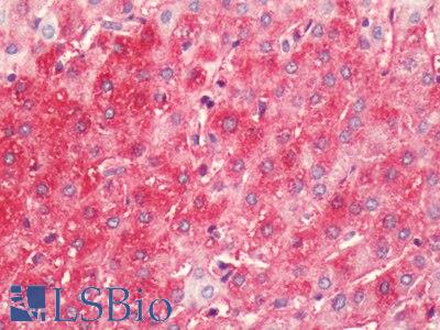 Human, Liver: Formalin-Fixed Paraffin-Embedded (FFPE)