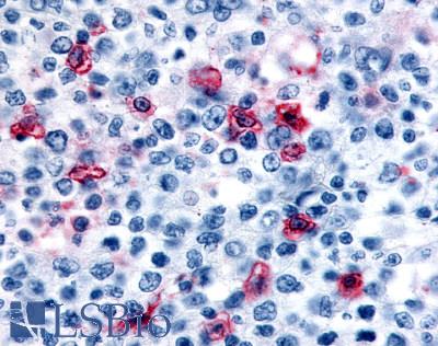 Anti-HRH4 / Histamine H4 Receptor antibody LS-A3775 IHC of human lymph node. Immunohistochemistry of formalin-fixed, paraffin-embedded tissue after heat-induced antigen retrieval.