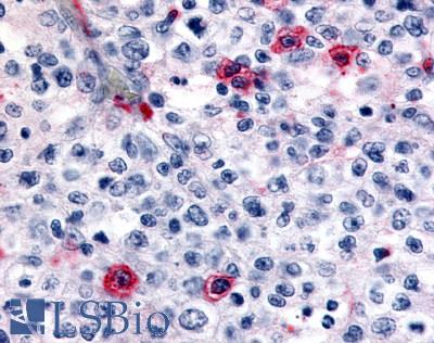 Anti-HRH4 / Histamine H4 Receptor antibody LS-A6816 IHC of human lymph node. Immunohistochemistry of formalin-fixed, paraffin-embedded tissue after heat-induced antigen retrieval.