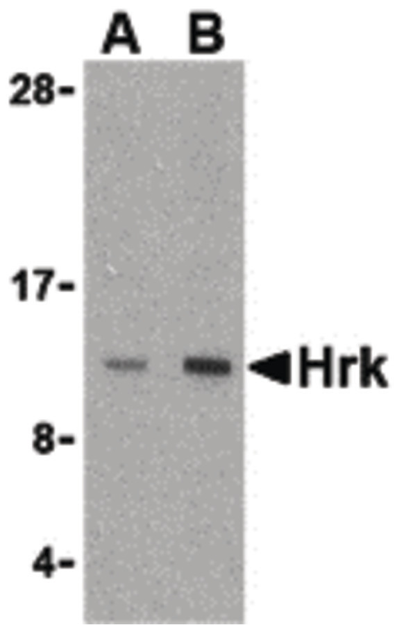 Western blot of Hrk in mouse pancreas tissue lysate with Hrk antibody at (A) 2.5 and (B) 5 ug/ml.