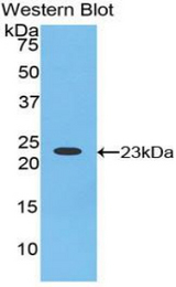 Western blot of recombinant HRNR / Hornerin.