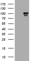 HEK293T cells were transfected with the pCMV6-ENTRY control (Left lane) or pCMV6-ENTRY HGS (Right lane) cDNA for 48 hrs and lysed. Equivalent amounts of cell lysates (5 ug per lane) were separated by SDS-PAGE and immunoblotted with anti-HGS.