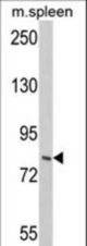 Western blot of hIMOS-1-Q271 in mouse spleen tissue lysates (35 ug/lane). IMOS-1 (arrow) was detected using the purified antibody.