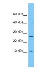 Western blot of UK114 Antibody with human Lymph node tumor lysate.